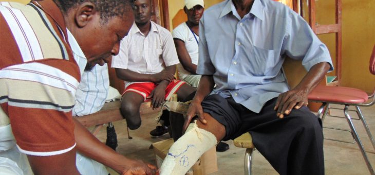 Prosthetics project for amputees continues in Bombali District