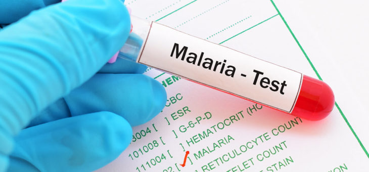 Testing for Malaria